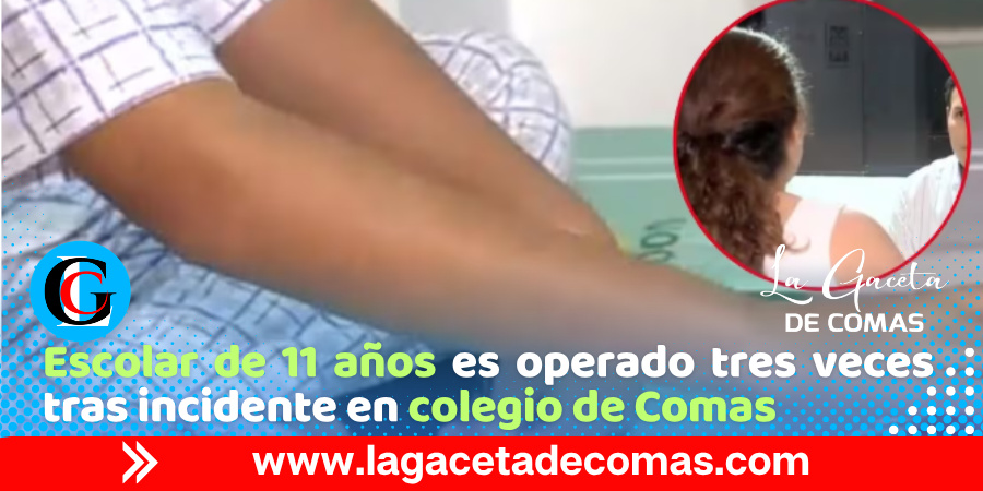 Comas: escolar sufre perforación intestinal tras sentarse sobre un lápiz