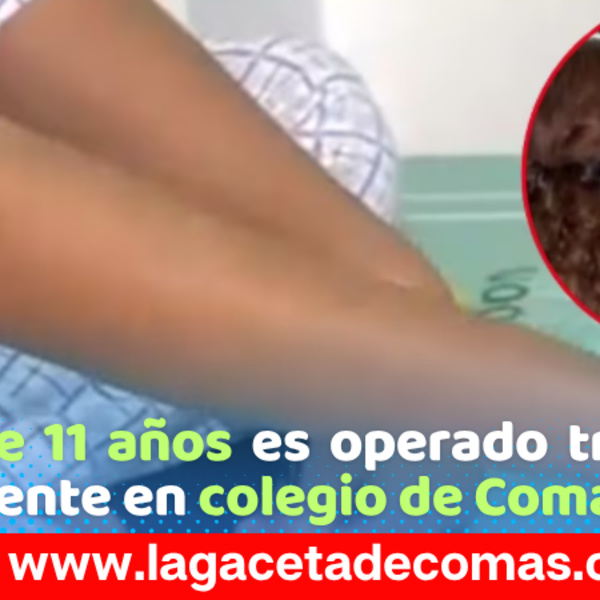 Comas: escolar sufre perforación intestinal tras sentarse sobre un lápiz
