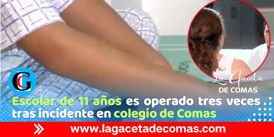Comas: escolar sufre perforación intestinal tras sentarse sobre un lápiz
