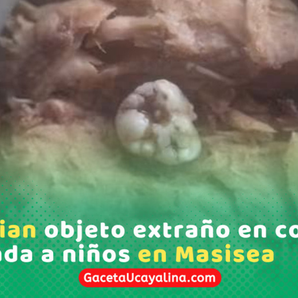 Escolares hallan presunto diente humano en conserva en Masisea