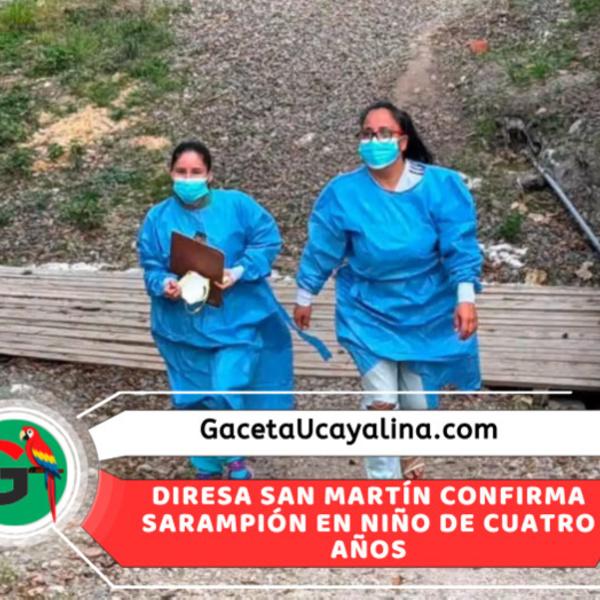 San Martín confirma primer caso de sarampión y activa operativo sanitario